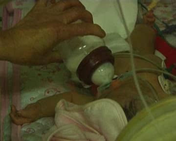 日本老太肛,揭示隐秘的老年健康挑战